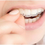 Отбеливание зубов в СК Ман